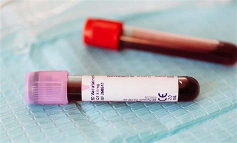 The world’s rarest blood type just got even stranger, only 3 people on ...