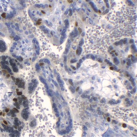 Cyclin E1-EP126 | PathnSitu Biotechnologies