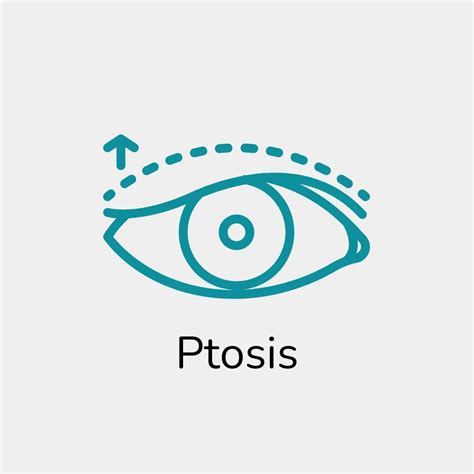 Eye Care Services - Treasure Coast Eye Specialists