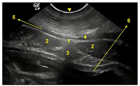 Surgical Anatomy for Sterilization Procedures in Female Capybaras