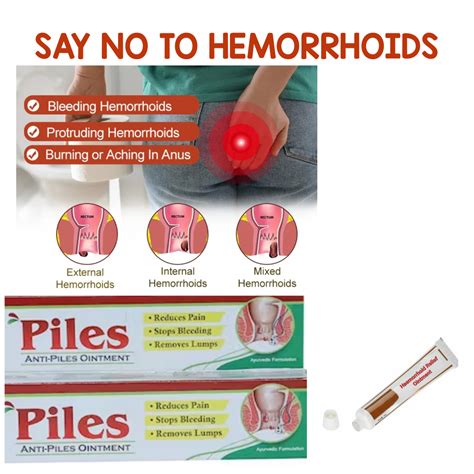 External Bleeding Hemorrhoid Treatment