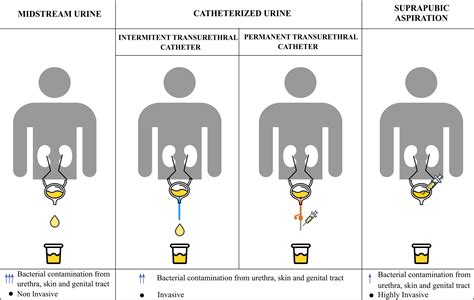 Frontiers | Urinary Microbiome: Yin and Yang of the Urinary Tract
