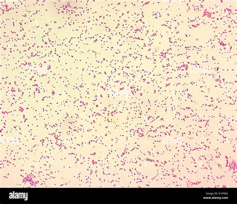 Brucella spp. are gram-negative in their staining morphology. Brucella ...