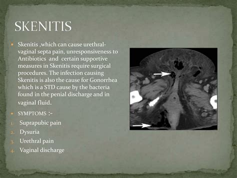 Skene’s gland anatomy features and functions | PPTX