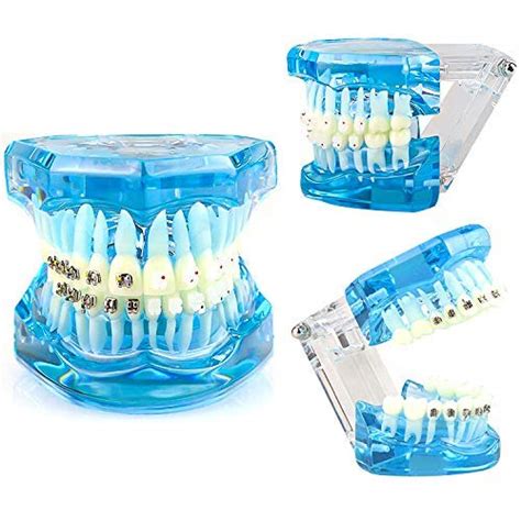Buy Orthodontic demonstration model Teeth to teach study tools with ...