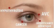 trou peau visage homme 6 choses que vos yeux sont en de vous dire sur votre trou peau visage homme 6 choses que vos yeux sont en de vous dire sur votre