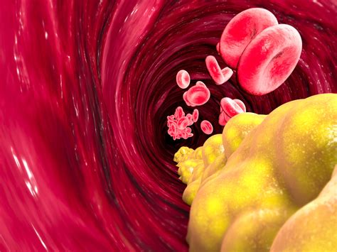 Understanding Cholesterol Numbers: What does total cholesterol, LDL ...