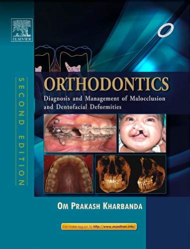 Buy Orthodontics: Diagnosis of & Management of Malocclusion ...