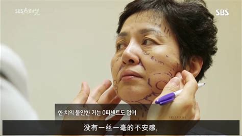 【韩国let美人医院】SBSspecial 中老年人整容前后对比