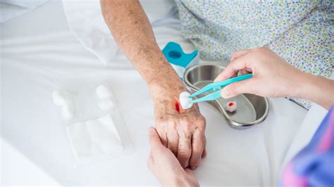 Essential Types of Wound Dressings for Effective Wound Care Nursing ...