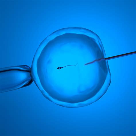Role of Intracytoplasmic sperm injection in IVF treatments in patients ...