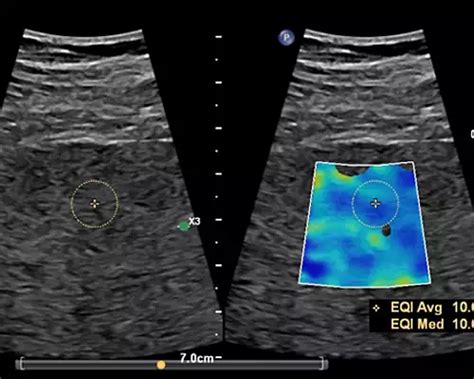 Auto ElastQ - Philips