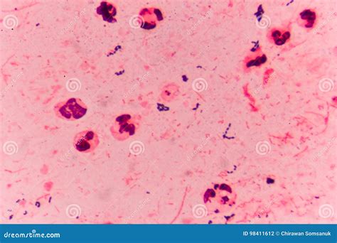 Bacteria Cells Gram Positive Cocci in Chain . Stock Photo - Image of ...