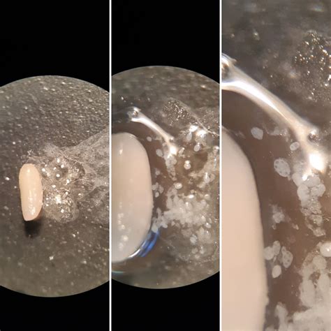 Tapeworm Proglottids Dog