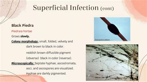 Dematiaceous fungi.pptx