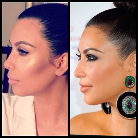 Kim Kardashian 2nd nose job plus lip injection facial contouring with cheek filler | Cosmetic ...