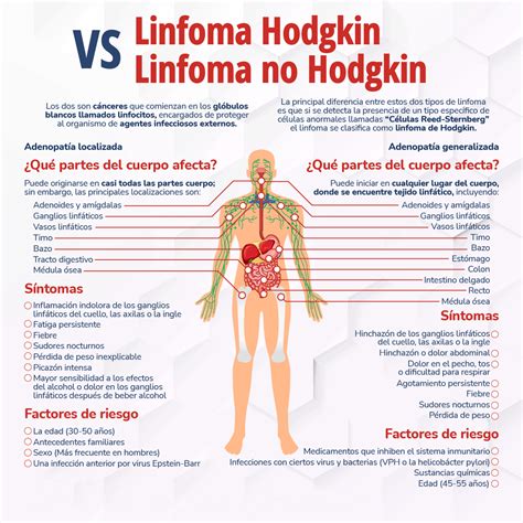 Linfoma de Hodgkin: uno de los cánceres más comunes en adolescentes y ...