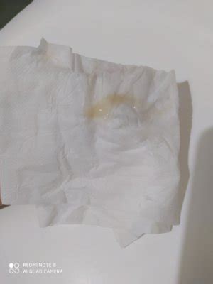 Muco clara de ovo (FOTO) | BabyCenter