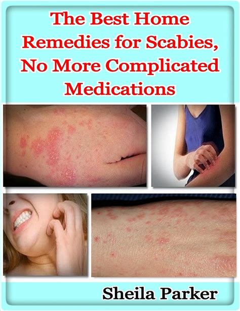 Scabies Treatment At Home