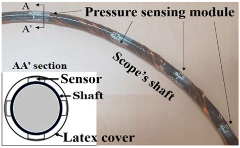A Pressure Sensing Device to Assist in Colonoscopic Procedures to ...