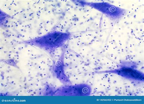 Neurons Cells from the Brain Under the Microscope View Stock Photo ...