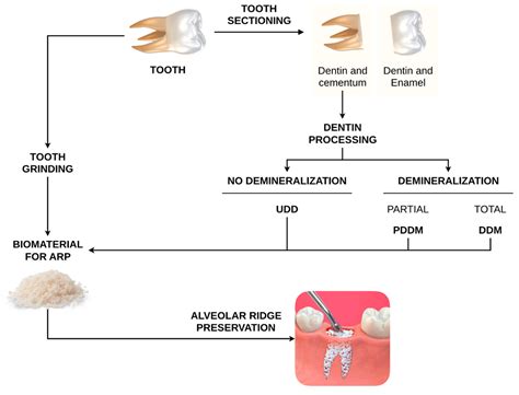 The Use of Autogenous Teeth for Alveolar Ridge Preservation: A ...