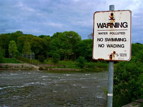 Schistosomiasis (Bilharzia) Causes, Symptoms, Diagnosis & Treatment