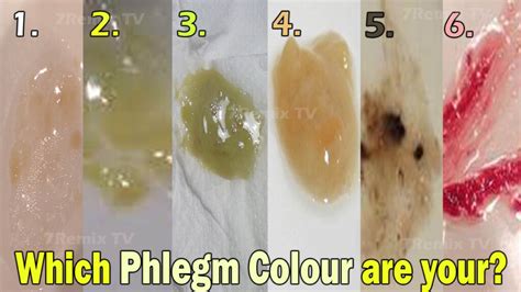 Chest Infection Yellow Phlegm Color Chart - Color-Chart.net