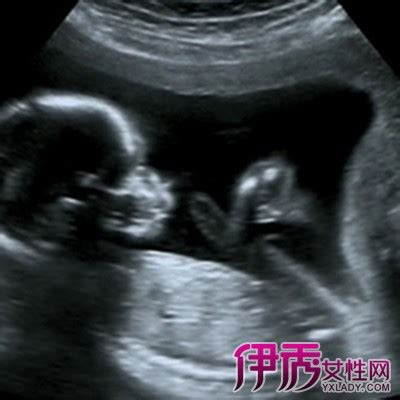 【b超单怎么算胎儿体重】【图】b超单怎么算胎儿体重 根据B超数据计算胎儿体重的公式(3)_伊秀亲子|yxlady.com