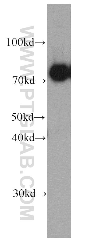 CPT1C antibody (66072-1-Ig) | Proteintech