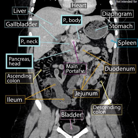 Gross Anatomy Glossary: Pancreas Imaging | ditki medical & biological sciences