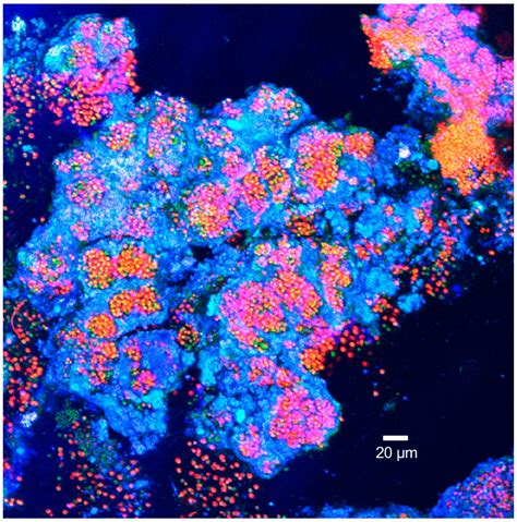 Initial Accretion in Hamelin Pool Microbialites: The Role of ...