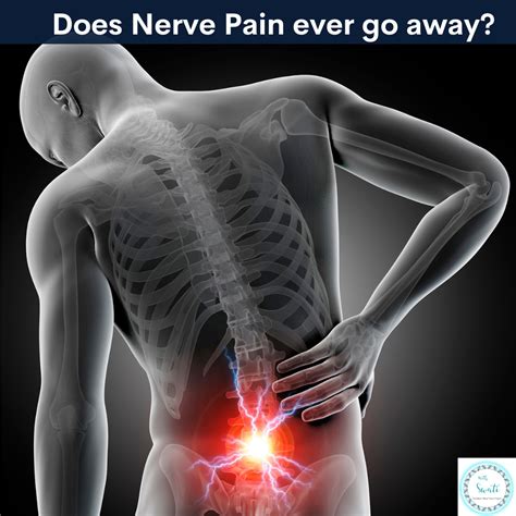 Does Nerve Pain ever go away? | Swati Prakash