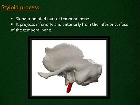 Radiological anatomy of_temporal_bone[1] | PPTX