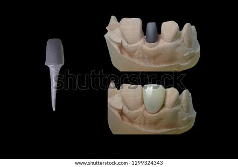 Image result for Metalcasting Core