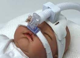 LDH may help predict hospitalization in neonates with Transient ...