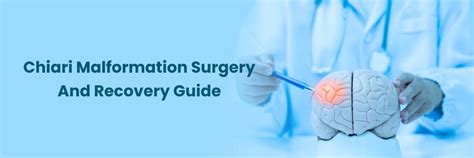 Bile Duct Cancer Risk Factors at Medicover Hospitals, Vizag