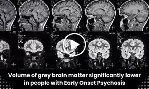Neurology & Neurosurgery Shorts