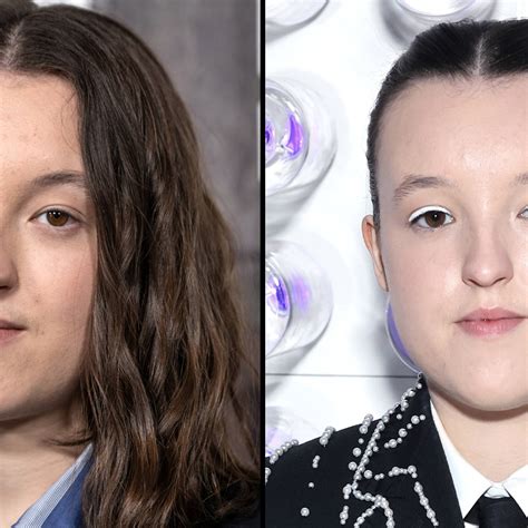 Millie Ramsey Face Surgery