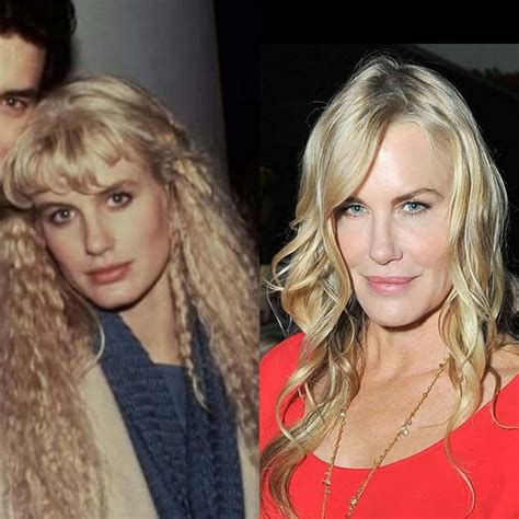 Bildergebnis für celebrities+that+have+plastic+surgery