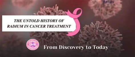 History of Radium in Cancer Treatment From Discovery to Today – Radium Care