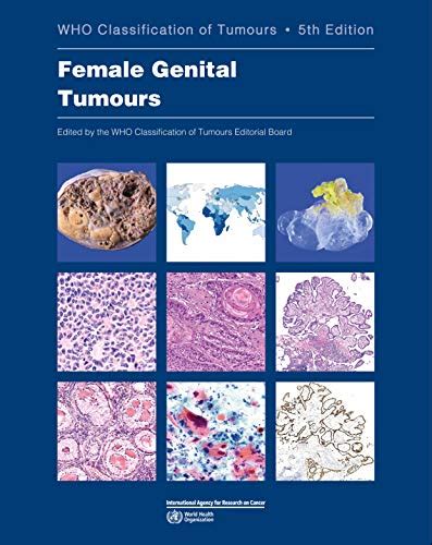 Buy WHO classification of female genital tumours: Who Classification of ...