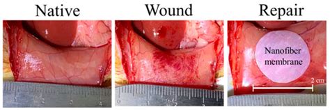 Polycaprolactone/Chitosan Composite Nanofiber Membrane as a Preferred ...