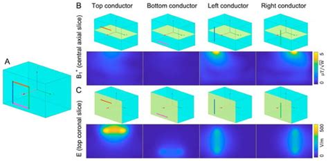 Improving Specific Absorption Rate Efficiency and Coil Robustness of ...