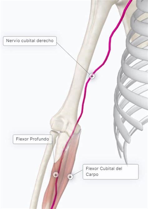 Plexo Braquial (V): Ramos Terminales del Fascículo Medial