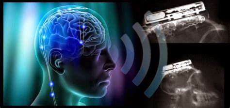 Brain Computer Interface Data Cable 的图像结果