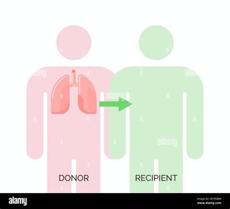 Human organ transplantation concept. Vector illustration of donor and recipient of lungs organ ...