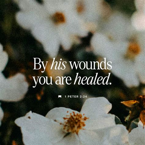 I. PETERU, 2:24-25 (SOV) - O le na aveina e ia lava a tatou ag | YouVersion