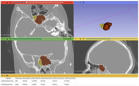 Tomography | An Open Access Journal from MDPI