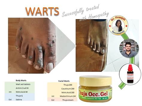 hpv 6 and 11 warts